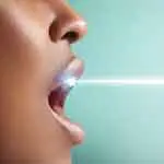 BLANQUEAMIENTO DENTAL LÁSER