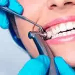 LIMPIEZA DENTAL COMPLETA